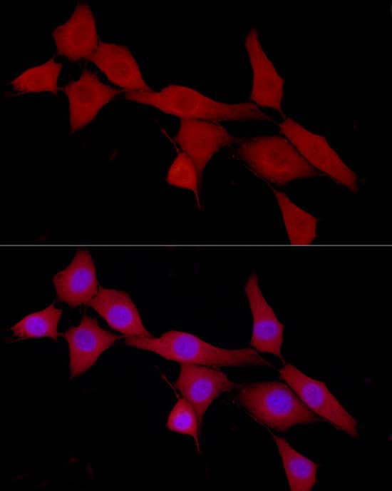 Immunocytochemistry/ Immunofluorescence: CAB39 Antibody - Azide and BSA Free [NBP2-92297] - Immunofluorescence analysis of NIH/3T3 cells using CAB39 Rabbit pAb  at dilution of 1:100 (40x lens). Secondary antibody: Cy3-conjugated Goat anti-Rabbit IgG (H+L)  at 1:500 dilution. Blue: DAPI for nuclear staining.