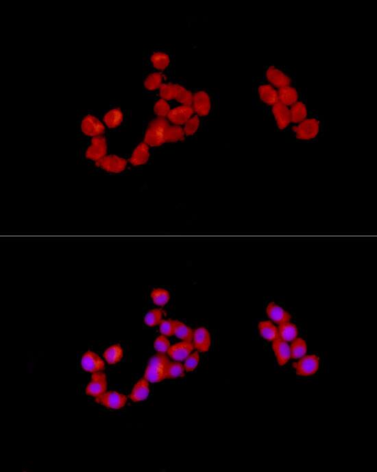 Immunocytochemistry/ Immunofluorescence: CAB39 Antibody - Azide and BSA Free [NBP2-92297] - Immunofluorescence analysis of PC-12 cells using CAB39 Rabbit pAb  at dilution of 1:100 (40x lens). Secondary antibody: Cy3-conjugated Goat anti-Rabbit IgG (H+L)  at 1:500 dilution. Blue: DAPI for nuclear staining.