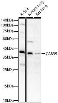 Western Blot: CAB39 Antibody - Azide and BSA Free [NBP2-92297] - Western blot analysis of various lysates, using CAB39 Rabbit pAb  at  1:700 dilution.Secondary antibody: HRP-conjugated Goat anti-Rabbit IgG (H+L)  at 1:10000 dilution.Lysates/proteins: 25ug per lane.Blocking buffer: 3% nonfat dry milk in TBST.Detection: ECL Basic Kit.Exposure time: 60s.