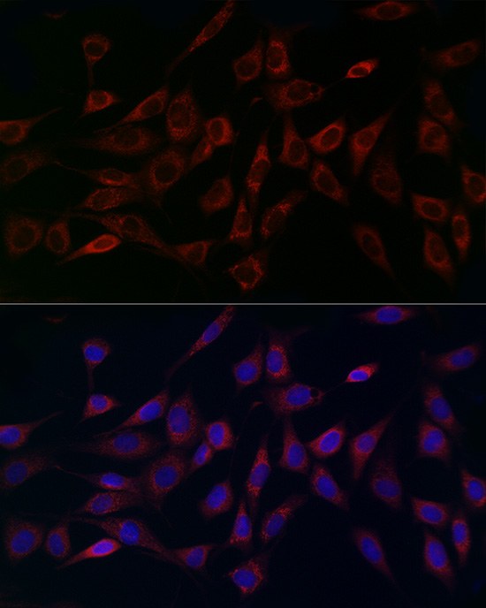 Immunocytochemistry/ Immunofluorescence: CCDC109A Antibody - Azide and BSA Free [NBP2-92310] - Immunofluorescence analysis of NIH/3T3 cells using CCDC109A Rabbit pAb  at dilution of 1:200 (40x lens). Secondary antibody: Cy3 Goat Anti-Rabbit IgG (H+L)  at 1:500 dilution. Blue: DAPI for nuclear staining.