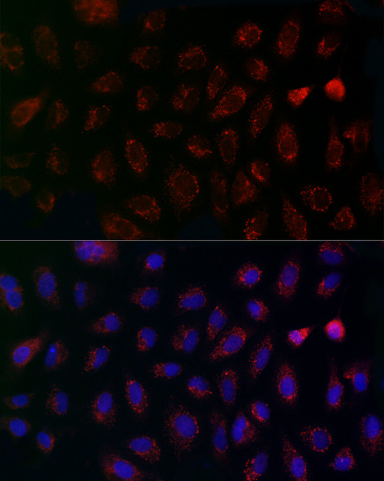 Immunocytochemistry/ Immunofluorescence: CCDC109A Antibody - Azide and BSA Free [NBP2-92310] - Immunofluorescence analysis of A-549 cells using CCDC109A Rabbit pAb  at dilution of 1:200 (40x lens). Secondary antibody: Cy3 Goat Anti-Rabbit IgG (H+L)  at 1:500 dilution. Blue: DAPI for nuclear staining.