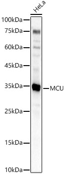 Western Blot: CCDC109A Antibody - Azide and BSA Free [NBP2-92310] - Western blot analysis of lysates from HeLa cells using CCDC109A Rabbit pAb at 1:2000 dilution.Secondary antibody: HRP Goat Anti-Rabbit IgG (H+L)  at 1:10000 dilution.Lysates/proteins: 25 ug per lane.Blocking buffer: 3% nonfat dry milk in TBST.Detection: ECL Basic Kit.Exposure time: 30s.