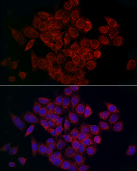 Immunocytochemistry/ Immunofluorescence: CCDC109A Antibody - Azide and BSA Free [NBP2-92310] - Immunofluorescence analysis of HeLa cells using CCDC109A Rabbit pAb  at dilution of 1:200 (40x lens). Secondary antibody: Cy3 Goat Anti-Rabbit IgG (H+L)  at 1:500 dilution. Blue: DAPI for nuclear staining.