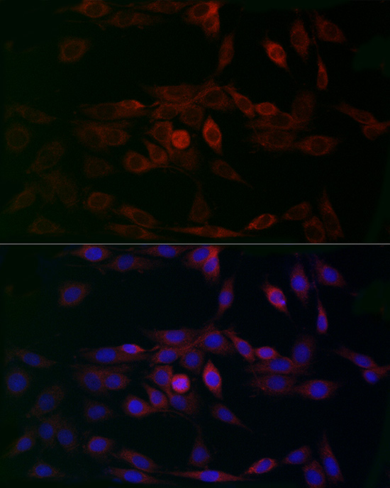Immunocytochemistry/ Immunofluorescence: CCDC109A Antibody - Azide and BSA Free [NBP2-92310] - Immunofluorescence analysis of PC-12 cells using CCDC109A Rabbit pAb  at dilution of 1:200 (40x lens). Secondary antibody: Cy3 Goat Anti-Rabbit IgG (H+L)  at 1:500 dilution. Blue: DAPI for nuclear staining.