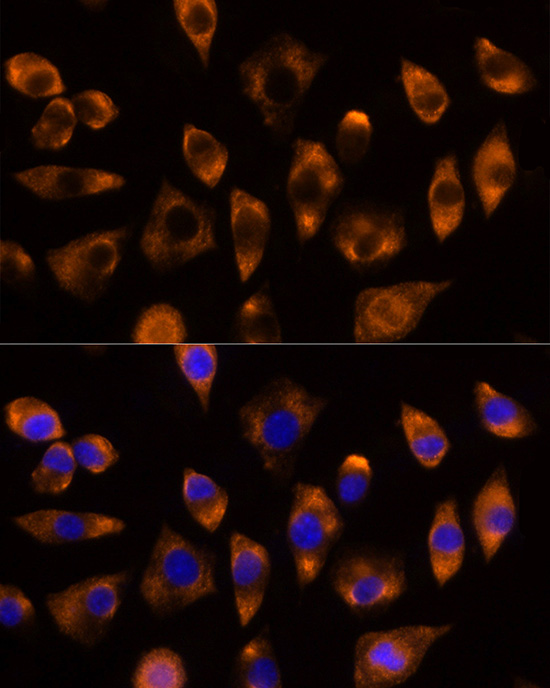 Immunocytochemistry/ Immunofluorescence: DUSP15 Antibody - Azide and BSA Free [NBP2-92313] - Immunofluorescence analysis of L929 cells using DUSP15 Rabbit pAb  at dilution of 1:100 (40x lens). Secondary antibody: Cy3 Goat Anti-Rabbit IgG (H+L)  at 1:500 dilution. Blue: DAPI for nuclear staining.