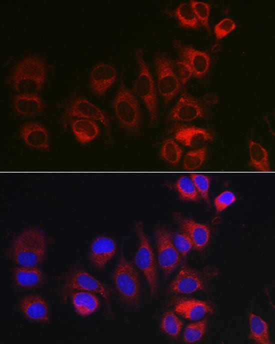 Immunocytochemistry/ Immunofluorescence: BOK Antibody - Azide and BSA Free [NBP2-92315] - Immunofluorescence analysis of MCF7 cells using BOK Rabbit pAb  at dilution of 1:100 (40x lens). Secondary antibody: Cy3-conjugated Goat anti-Rabbit IgG (H+L)  at 1:500 dilution. Blue: DAPI for nuclear staining.
