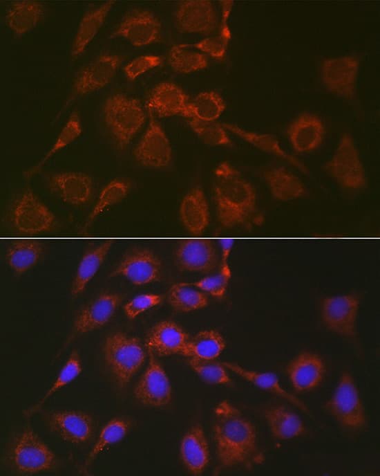 Immunocytochemistry/ Immunofluorescence: BOK Antibody - Azide and BSA Free [NBP2-92315] - Immunofluorescence analysis of NIH/3T3 cells using BOK Rabbit pAb  at dilution of 1:100 (40x lens). Secondary antibody: Cy3-conjugated Goat anti-Rabbit IgG (H+L)  at 1:500 dilution. Blue: DAPI for nuclear staining.