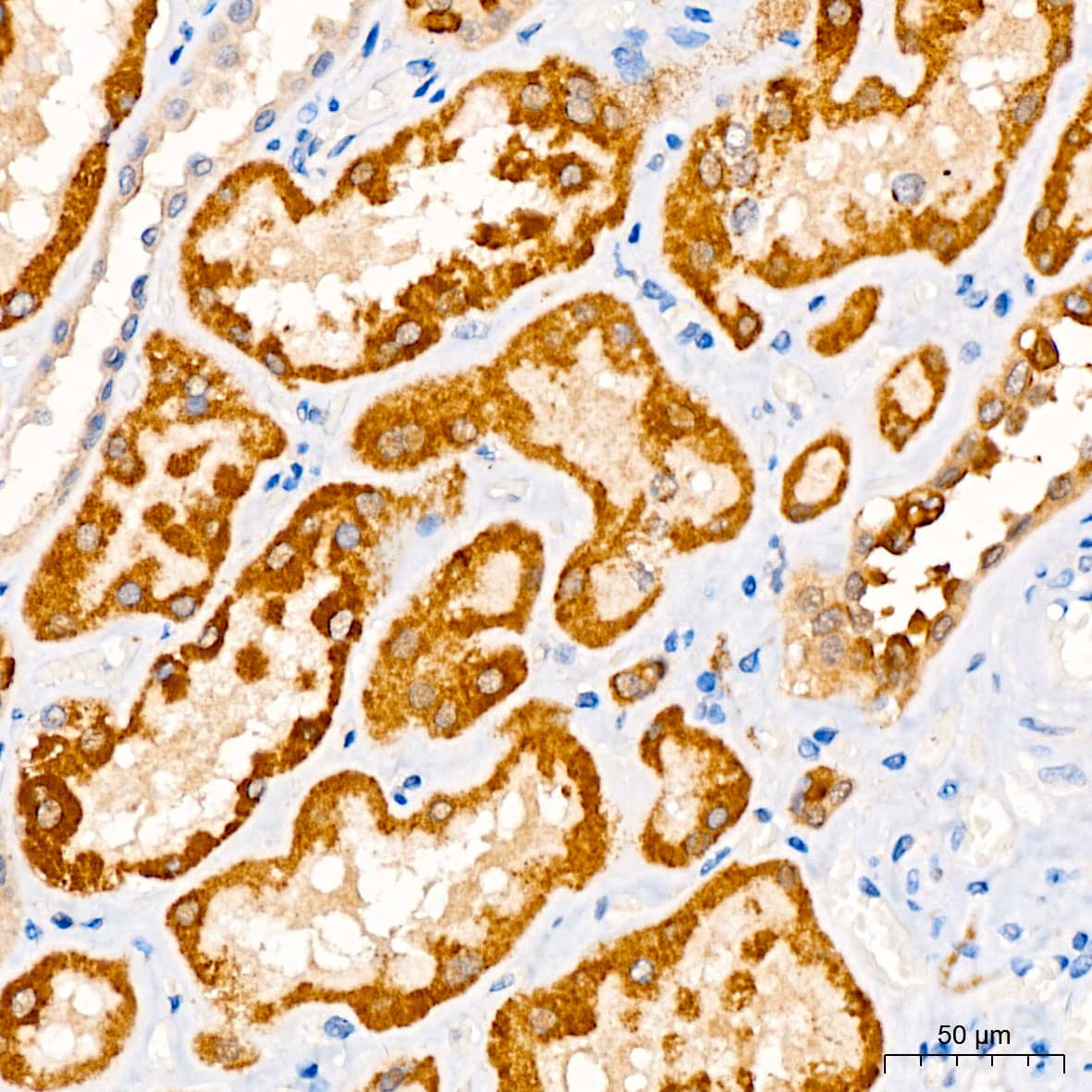 Immunohistochemistry: Choline dehydrogenase Antibody - Azide and BSA Free [NBP2-92326] - Immunohistochemistry analysis of paraffin-embedded Human kidney using Choline dehydrogenase Rabbit pAb  at dilution of 1:100 (40x lens). High pressure antigen retrieval performed with 0.01M Citrate Bufferr (pH 6.0) prior to IHC staining.