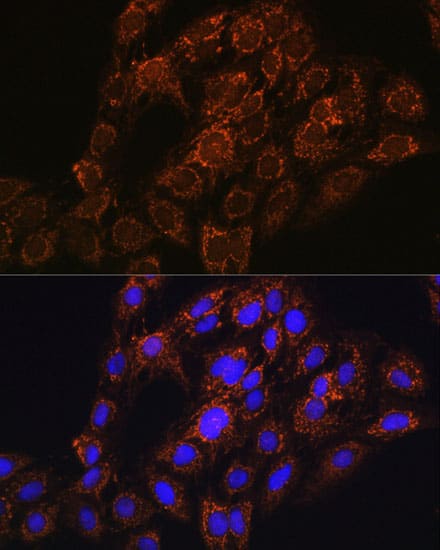 Immunocytochemistry/ Immunofluorescence: CHCHD2 Antibody - Azide and BSA Free [NBP2-92335] - Immunofluorescence analysis of C6 cells using [KO Validated] CHCHD2 Rabbit pAb  at dilution of 1:100. Secondary antibody: Cy3 Goat Anti-Rabbit IgG (H+L)  at 1:500 dilution. Blue: DAPI for nuclear staining.