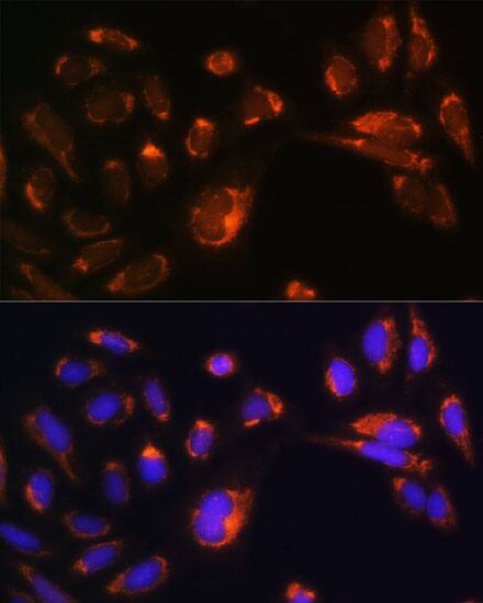Immunocytochemistry/ Immunofluorescence: CHCHD2 Antibody - Azide and BSA Free [NBP2-92335] - Immunofluorescence analysis of U-2 OS cells using [KO Validated] CHCHD2 Rabbit pAb  at dilution of 1:100. Secondary antibody: Cy3 Goat Anti-Rabbit IgG (H+L)  at 1:500 dilution. Blue: DAPI for nuclear staining.