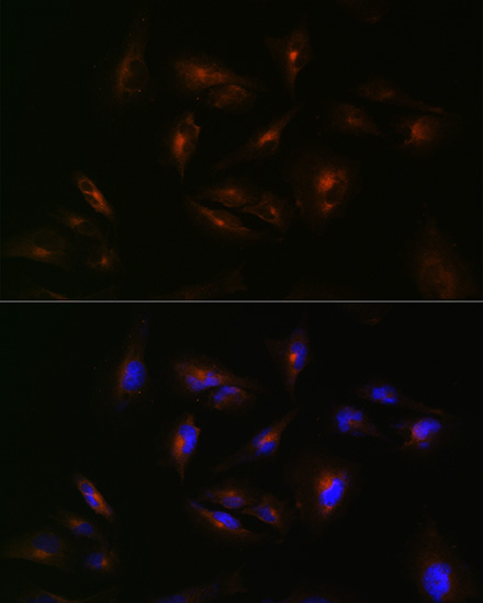 Immunocytochemistry/ Immunofluorescence: ABCA2 Antibody - Azide and BSA Free [NBP2-92339] - Immunofluorescence analysis of U-251 MG cells using ABCA2 Rabbit pAb  at dilution of 1:100 (40x lens). Secondary antibody: Cy3 Goat Anti-Rabbit IgG (H+L)  at 1:500 dilution. Blue: DAPI for nuclear staining.