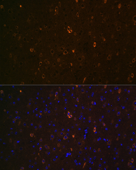 Immunocytochemistry/ Immunofluorescence: ABCA2 Antibody - Azide and BSA Free [NBP2-92339] - Immunofluorescence analysis of paraffin-embedded mouse brain using ABCA2 Rabbit pAb  at dilution of 1:100 (40x lens). Secondary antibody: Cy3 Goat Anti-Rabbit IgG (H+L)  at 1:500 dilution. Blue: DAPI for nuclear staining.