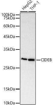 Western Blot: CIDEB Antibody [NBP2-92347] -  Analysis of various lysates, using CIDEB antibody at 1:2000 dilution.Secondary antibody: HRP Goat Anti-Rabbit IgG (H+L) at 1:10000 dilution.Lysates/proteins: 25ug per lane.Blocking buffer: 3% nonfat dry milk in TBST.Detection: ECL Basic Kit. Exposure time: 10s.