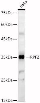 Western Blot: BXDC1 Antibody - Azide and BSA Free [NBP2-92352] - Western blot analysis of lysates from HeLa cells, using BXDC1 Rabbit pAb  at  1:500 dilution.Secondary antibody: HRP-conjugated Goat anti-Rabbit IgG (H+L)  at 1:10000 dilution.Lysates/proteins: 25ug per lane.Blocking buffer: 3% nonfat dry milk in TBST.Detection: ECL Basic Kit.Exposure time: 60s.