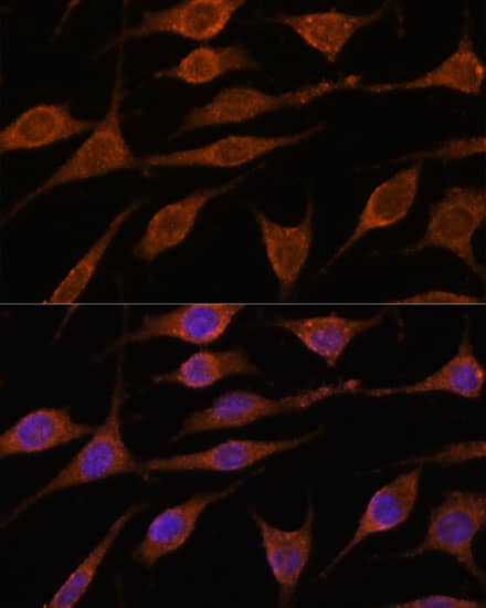Immunocytochemistry/ Immunofluorescence: ALG5 Antibody - Azide and BSA Free [NBP2-92371] - Immunofluorescence analysis of L929 cells using ALG5 Rabbit pAb  at dilution of 1:100. Secondary antibody: Cy3 Goat Anti-Rabbit IgG (H+L)  at 1:500 dilution. Blue: DAPI for nuclear staining.
