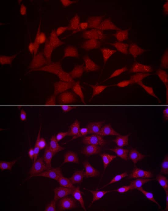 Immunocytochemistry/ Immunofluorescence: DUSP8 Antibody - Azide and BSA Free [NBP2-92392] - Immunofluorescence analysis of NIH/3T3 cells using DUSP8 Rabbit pAb  at dilution of 1:1000 (40x lens). Secondary antibody: Cy3-conjugated Goat anti-Rabbit IgG (H+L)  at 1:500 dilution. Blue: DAPI for nuclear staining.