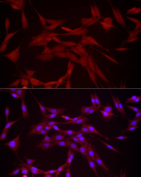 Immunocytochemistry/ Immunofluorescence DUSP8 Antibody - Azide and BSA Free