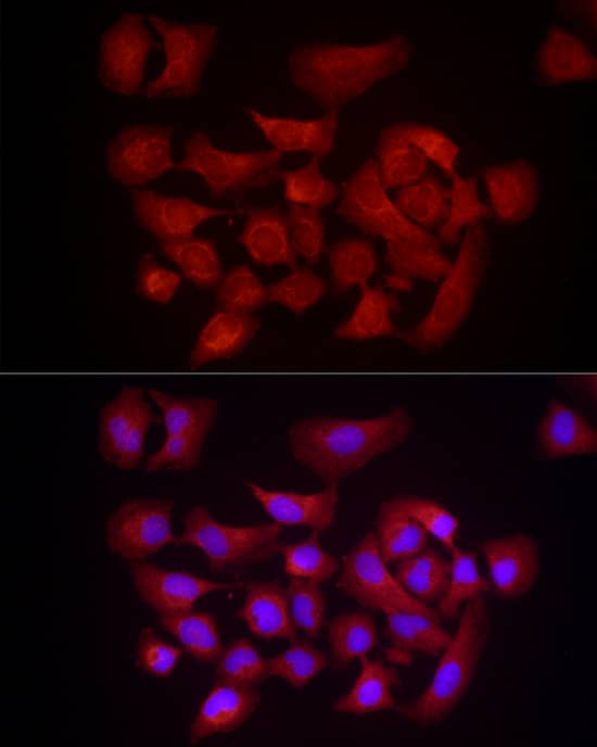 Immunocytochemistry/ Immunofluorescence: DUSP8 Antibody - Azide and BSA Free [NBP2-92392] - Immunofluorescence analysis of HeLa cells using DUSP8 Rabbit pAb  at dilution of 1:1000 (40x lens). Secondary antibody: Cy3-conjugated Goat anti-Rabbit IgG (H+L)  at 1:500 dilution. Blue: DAPI for nuclear staining.