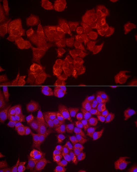 Immunocytochemistry/ Immunofluorescence DUSP8 Antibody - Azide and BSA Free