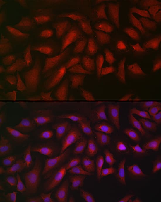 Immunocytochemistry/ Immunofluorescence: ATF5 Antibody - Azide and BSA Free [NBP2-92397] - Immunofluorescence analysis of U2OS cells using ATF5 Rabbit pAb  at dilution of 1:20 (40x lens). Secondary antibody: Cy3-conjugated Goat anti-Rabbit IgG (H+L)  at 1:500 dilution. Blue: DAPI for nuclear staining.