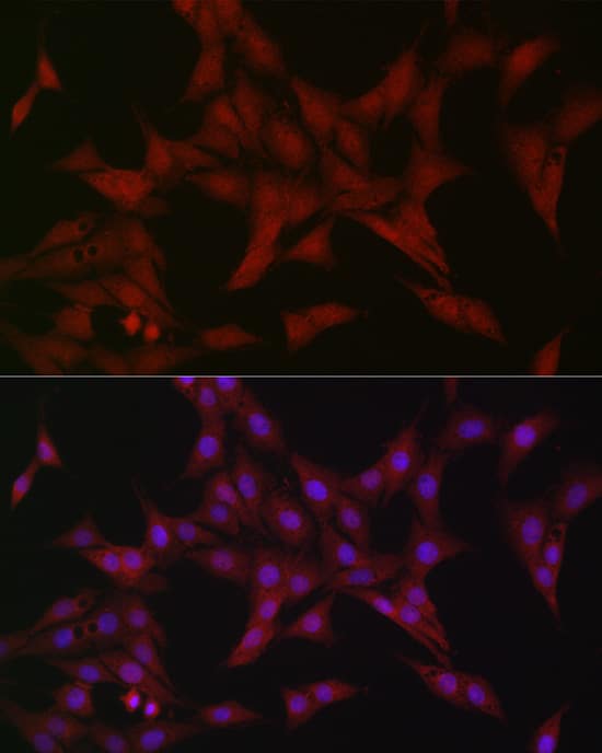 Immunocytochemistry/ Immunofluorescence: ATF5 Antibody - Azide and BSA Free [NBP2-92397] - Immunofluorescence analysis of PC-12 cells using ATF5 Rabbit pAb  at dilution of 1:20 (40x lens). Secondary antibody: Cy3-conjugated Goat anti-Rabbit IgG (H+L)  at 1:500 dilution. Blue: DAPI for nuclear staining.