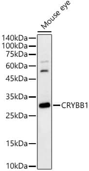 Western Blot: beta B1 Crystallin Antibody - BSA Free [NBP2-92412] - Western blot analysis of various lysates, using beta B1 Crystallin Rabbit pAb  at 1:1000 dilution.Secondary antibody: HRP-conjugated Goat anti-Rabbit IgG (H+L)  at 1:10000 dilution.Lysates/proteins: 25ug per lane.Blocking buffer: 3% nonfat dry milk in TBST.Detection: ECL Basic Kit.Exposure time: 180s.