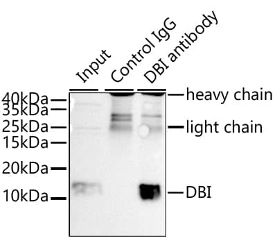 Immunoprecipitation: ACBP Antibody - BSA Free [NBP2-92457] - Immunoprecipitation of ACBP from 300 ug extracts of 293T cells was performed using 3 ug of ACBP Rabbit pAb . Rabbit IgG isotype control  was used to precipitate the Control IgG sample. IP samples were eluted with 1X Laemmli Buffer. The Input lane represents 10% of the total input. Western blot analysis of immunoprecipitates was conducted using ACBP Rabbit pAb  at a dilution of 1:1000.