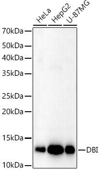 Western Blot: ACBP Antibody - BSA Free [NBP2-92457] - Western blot analysis of various lysates, using ACBP Rabbit pAb  at  1:1000 dilution.Secondary antibody: HRP-conjugated Goat anti-Rabbit IgG (H+L)  at 1:10000 dilution.Lysates/proteins: 25ug per lane.Blocking buffer: 3% nonfat dry milk in TBST.Detection: ECL Enhanced Kit.Exposure time: 180s.