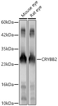 Western Blot: CRYBB2 Antibody - BSA Free [NBP2-92459] - Western blot analysis of various lysates, using CRYBB2 Rabbit pAb  at 1:2000 dilution.Secondary antibody: HRP Goat Anti-Rabbit IgG (H+L)  at 1:10000 dilution.Lysates/proteins: 25ug per lane.Blocking buffer: 3% nonfat dry milk in TBST.Detection: ECL Enhanced Kit.Exposure time: 60s.