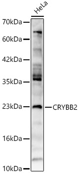 Western Blot CRYBB2 Antibody - BSA Free