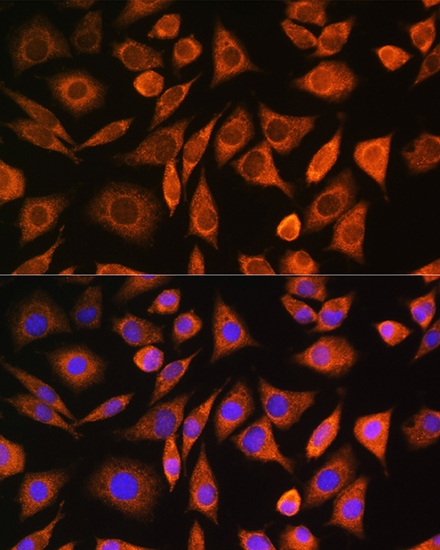 Immunocytochemistry/ Immunofluorescence CNOT1 Antibody - Azide and BSA Free