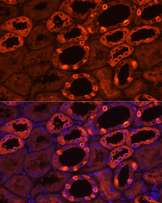 Immunocytochemistry/ Immunofluorescence: ATP6V1B1 Antibody - BSA Free [NBP2-92479] - Immunofluorescence analysis of human kidney using ATP6V1B1 Rabbit pAb  at dilution of 1:200 (40x lens). Blue: DAPI for nuclear staining.