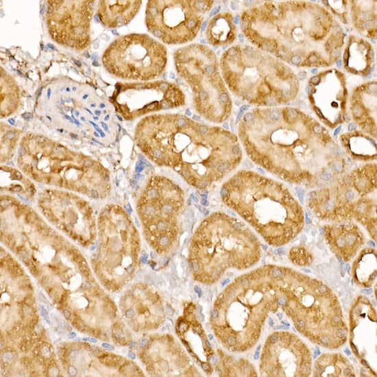 Immunohistochemistry: BTNL2/Butyrophilin-like 2 Antibody - Azide and BSA Free [NBP2-92488] - Immunohistochemistry analysis of paraffin-embedded Rat kidney using BTNL2/Butyrophilin-like 2 Rabbit pAb  at dilution of 1:400 (40x lens). High pressure antigen retrieval performed with 0.01M Citrate Bufferr (pH 6.0) prior to IHC staining.