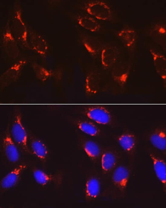 Immunocytochemistry/ Immunofluorescence: COPB2 Antibody - Azide and BSA Free [NBP2-92501] - Immunofluorescence analysis of U2OS cells using COPB2 Rabbit pAb  at dilution of 1:100 (40x lens). Secondary antibody: Cy3-conjugated Goat anti-Rabbit IgG (H+L)  at 1:500 dilution. Blue: DAPI for nuclear staining.