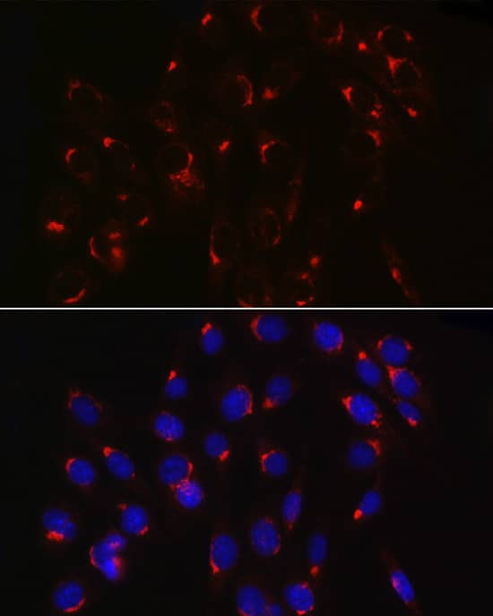 Immunocytochemistry/ Immunofluorescence: COPB2 Antibody - Azide and BSA Free [NBP2-92501] - Immunofluorescence analysis of NIH/3T3 cells using COPB2 Rabbit pAb  at dilution of 1:100 (40x lens). Secondary antibody: Cy3-conjugated Goat anti-Rabbit IgG (H+L)  at 1:500 dilution. Blue: DAPI for nuclear staining.