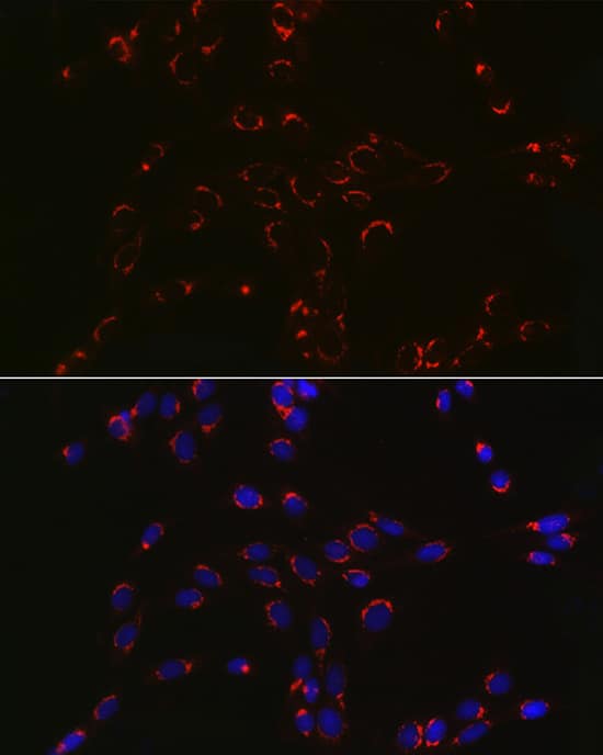 Immunocytochemistry/ Immunofluorescence: COPB2 Antibody - Azide and BSA Free [NBP2-92501] - Immunofluorescence analysis of PC-12 cells using COPB2 Rabbit pAb  at dilution of 1:100 (40x lens). Secondary antibody: Cy3-conjugated Goat anti-Rabbit IgG (H+L)  at 1:500 dilution. Blue: DAPI for nuclear staining.