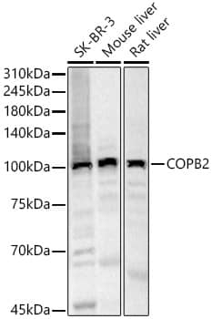 Western Blot: COPB2 Antibody - Azide and BSA Free [NBP2-92501] - Western blot analysis of various lysates, using COPB2 Rabbit pAb  at  1:500 dilution.Secondary antibody: HRP-conjugated Goat anti-Rabbit IgG (H+L)  at 1:10000 dilution.Lysates/proteins: 25ug per lane.Blocking buffer: 3% nonfat dry milk in TBST.Detection: ECL Basic Kit.Exposure time: 30s.