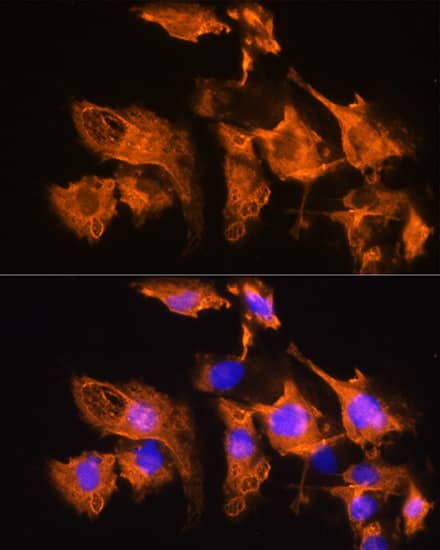 Immunocytochemistry/ Immunofluorescence: ARF4 Antibody - Azide and BSA Free [NBP2-92502] - Immunofluorescence analysis of C6 cells using ARF4 Rabbit pAb  at dilution of 1:100. Secondary antibody: Cy3-conjugated Goat anti-Rabbit IgG (H+L)  at 1:500 dilution. Blue: DAPI for nuclear staining.