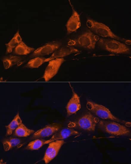 Immunocytochemistry/ Immunofluorescence: ARF4 Antibody - Azide and BSA Free [NBP2-92502] - Immunofluorescence analysis of NIH/3T3 cells using ARF4 Rabbit pAb  at dilution of 1:100. Secondary antibody: Cy3-conjugated Goat anti-Rabbit IgG (H+L)  at 1:500 dilution. Blue: DAPI for nuclear staining.