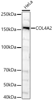 Western Blot: COL4A2 Antibody - BSA Free [NBP2-92506] - Western blot analysis of HeLa, using COL4A2 Rabbit pAb  at 1:900 dilution.Secondary antibody: HRP Goat Anti-Rabbit IgG (H+L)  at 1:10000 dilution.Lysates/proteins: 25ug per lane.Blocking buffer: 3% nonfat dry milk in TBST.Detection: ECL Basic Kit.Exposure time: 180s.