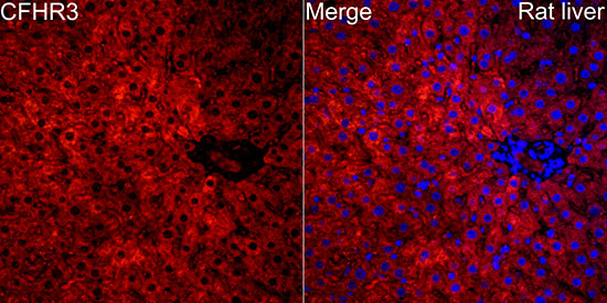 Immunocytochemistry/ Immunofluorescence Complement Factor H-related 3/CFHR3 Antibody - BSA Free