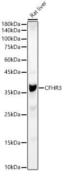 Western Blot Complement Factor H-related 3/CFHR3 Antibody - BSA Free