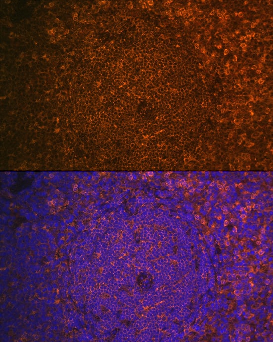 Immunocytochemistry/ Immunofluorescence: Cystatin F Antibody - BSA Free [NBP2-92532] - Immunofluorescence analysis of paraffin-embedded Mouse spleen using Cystatin F Rabbit pAb  at dilution of 1:100. Secondary antibody: Cy3-conjugated Goat anti-Rabbit IgG (H+L)  at 1:500 dilution. Blue: DAPI for nuclear staining.