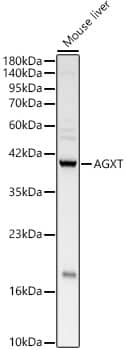 Western Blot: AGXT Antibody - BSA Free [NBP2-92542] - Western blot analysis of lysates from Mouse liver, using AGXT Rabbit pAb  at  1:3000 dilution.Secondary antibody: HRP Goat Anti-Rabbit IgG (H+L)  at 1:10000 dilution.Lysates/proteins: 25ug per lane.Blocking buffer: 3% nonfat dry milk in TBST.Detection: ECL Basic Kit.Exposure time: 1s.