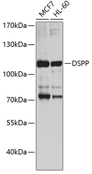 Western Blot: DSPP Antibody - Azide and BSA Free [NBP2-92546] - Western blot analysis of various lysates using DSPP Rabbit pAb  at 1:1000 dilution.&lt;br&gt;Secondary antibody: HRP Goat Anti-Rabbit IgG (H+L)  at 1:10000 dilution.&lt;br&gt;Lysates/proteins: 25ug per lane.&lt;br&gt;Blocking buffer: 3% nonfat dry milk in TBST.&lt;br&gt;Detection: ECL Basic Kit.&lt;br&gt;Exposure time: 30s.