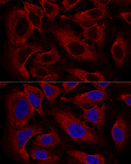 Immunocytochemistry/ Immunofluorescence ARL8B Antibody - Azide and BSA Free