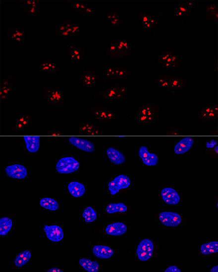 Immunocytochemistry/ Immunofluorescence: EBNA1BP2 Antibody - BSA Free [NBP2-92575] - Confocal immunofluorescence analysis of U2OS cells using EBNA1BP2 Polyclonal Antibody  at dilution of 1:200. Blue: DAPI for nuclear staining.