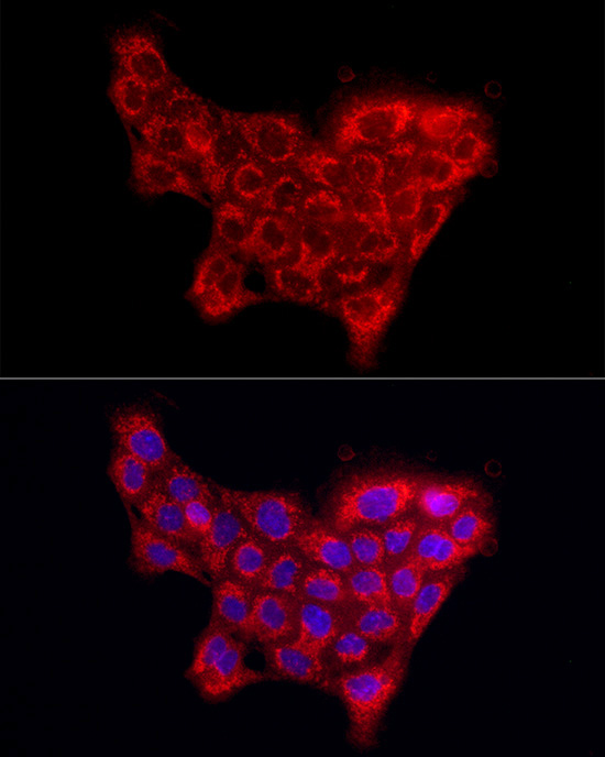 Immunocytochemistry/ Immunofluorescence Collagen IV alpha5 Antibody - BSA Free