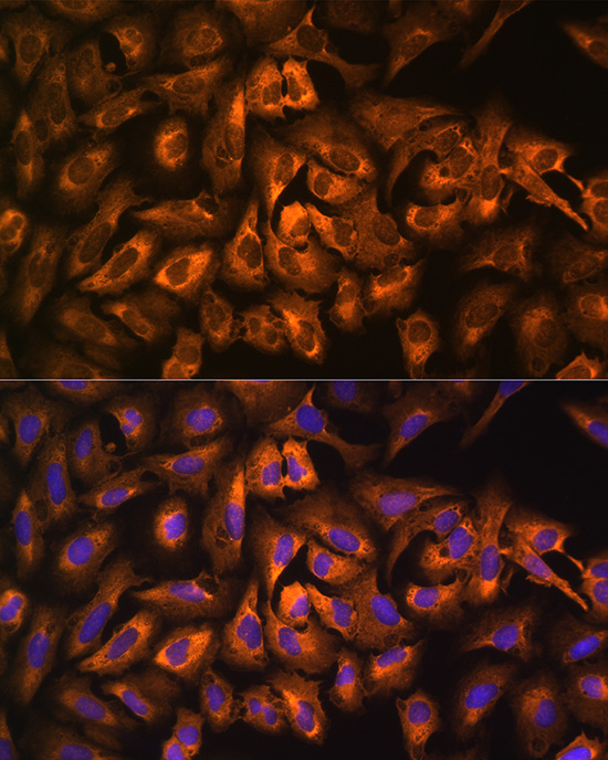 Immunocytochemistry/ Immunofluorescence: eEF1A1 Antibody - BSA Free [NBP2-92598] - Immunofluorescence analysis of U2OS cells using eEF1A1 Rabbit pAb  at dilution of 1:100 (40x lens). Blue: DAPI for nuclear staining.