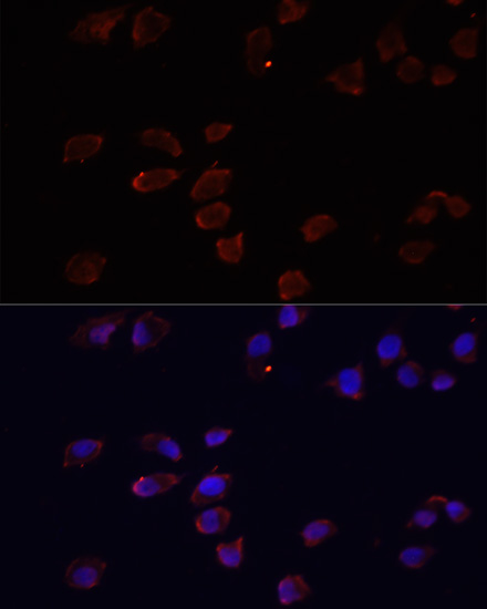 Immunocytochemistry/ Immunofluorescence: ARF6 Antibody - BSA Free [NBP2-92599] - Immunofluorescence analysis of HeLa cells using ARF6 antibody  at dilution of 1:100. Blue: DAPI for nuclear staining.